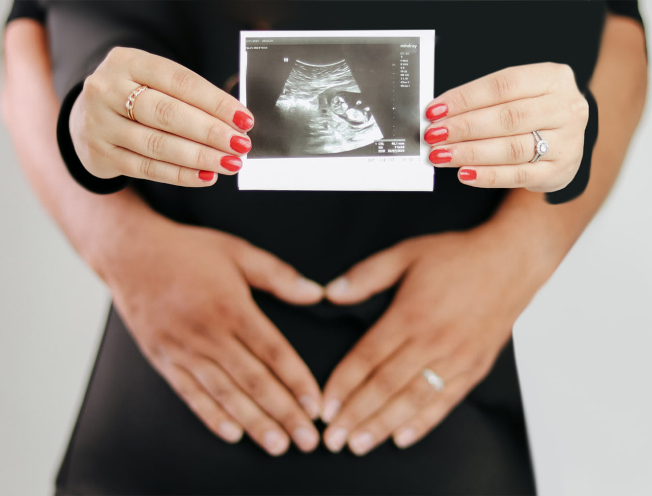 عکاسی بارداری در فضای باز با لباس سفید نکات قبل از عکاسی بارداری ژست‌های زیبا برای عکاسی بارداری عکس مادر باردار با همسر در آتلیه اکسسوری‌های خاص برای عکاسی بارداری